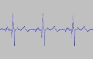 BioBeat ECG data